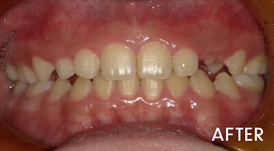 after