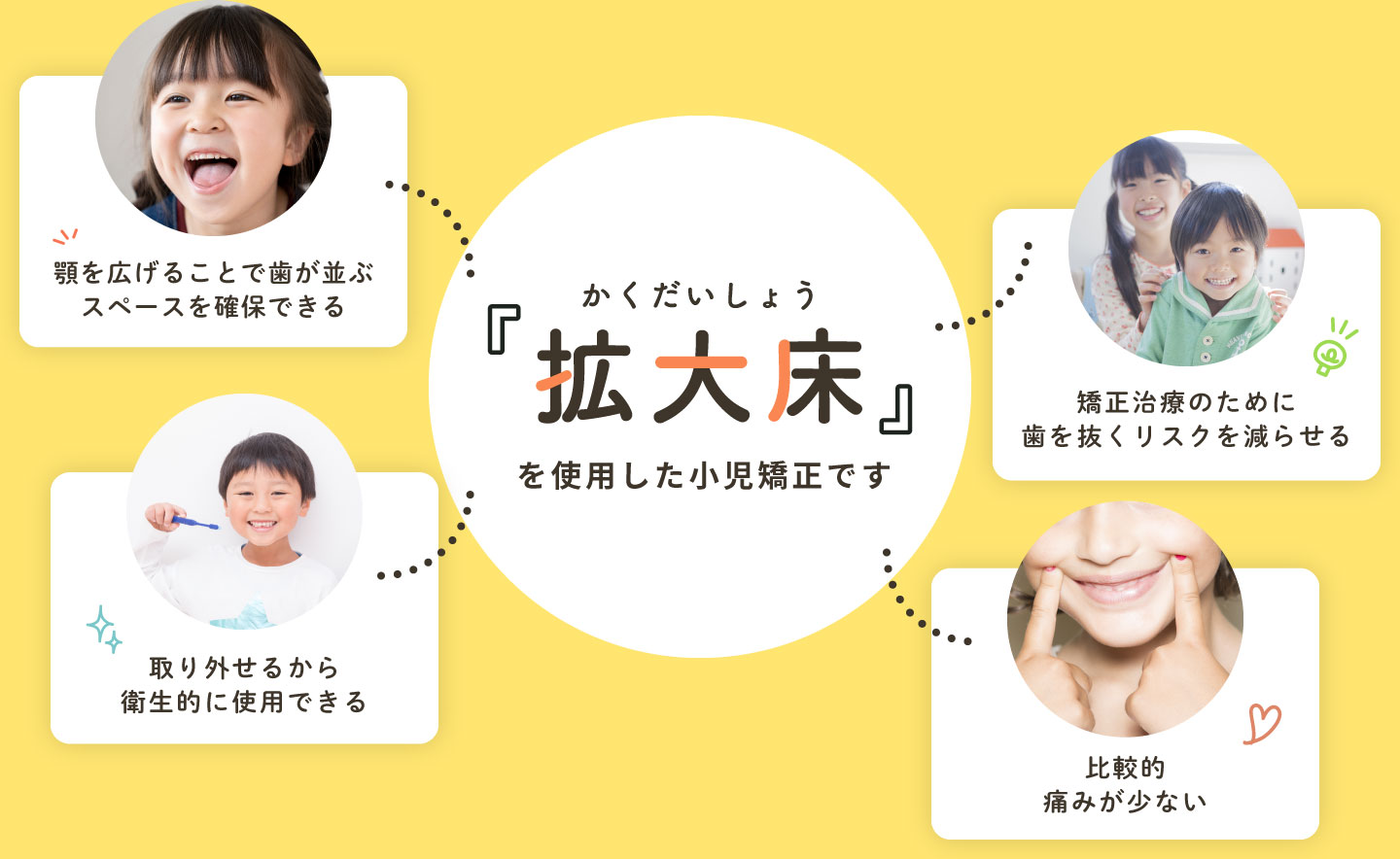 拡大床を使用した小児矯正です。顎を広げることで歯が並ぶスペースを確保できる、取り外せるから衛生的に使用できる、矯正治療のために歯を抜くリスクを減らせる、比較的痛みが少ない