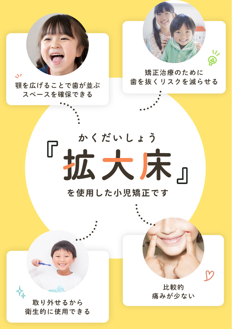 拡大床を使用した小児矯正です。顎を広げることで歯が並ぶスペースを確保できる、取り外せるから衛生的に使用できる、矯正治療のために歯を抜くリスクを減らせる、比較的痛みが少ない